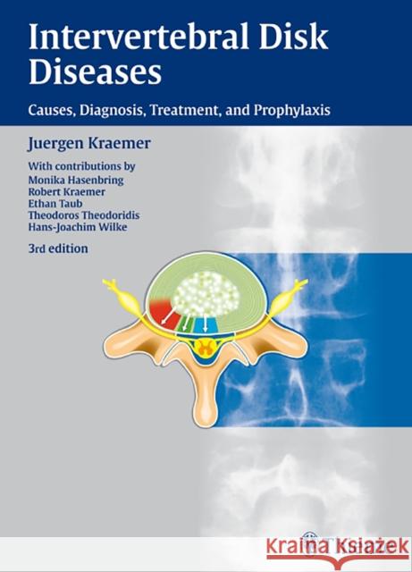 Intervertebral Disk Diseases: Causes, Diagnosis, Treatment, and Prophylaxis Krämer, Jürgen 9783135824031 Thieme Medical Publishers - książka