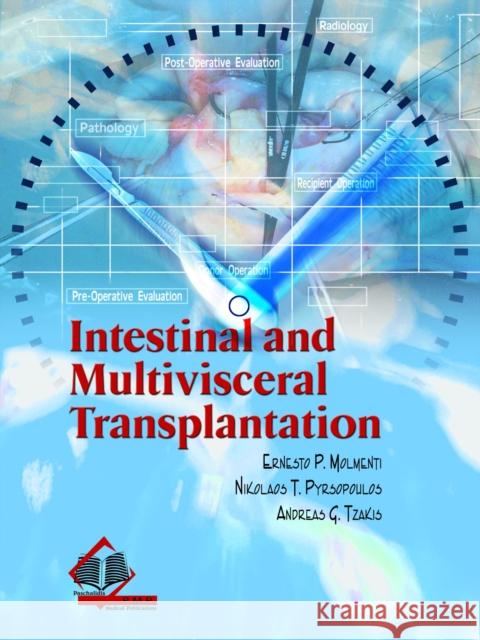Intestinal and Multivisceral Transplantation Molmenti, Ernesto P. 9789603997894 Paschalidis Medical Publications - książka