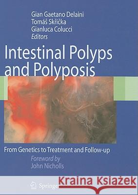 Intestinal Polyps and Polyposis: From Genetics to Treatment and Follow-Up Delaini, G. G. 9788847011236 Springer - książka