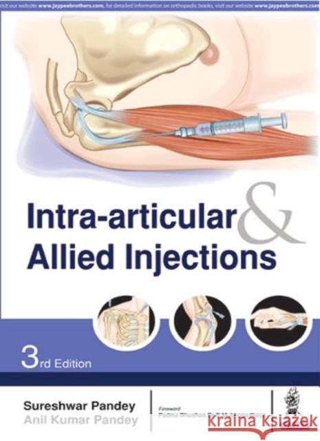 Intra-articular & Allied Injections Sureshwar Pandey, Anil Kumar Pandey 9789352701308 Jaypee Brothers Medical Publishers - książka