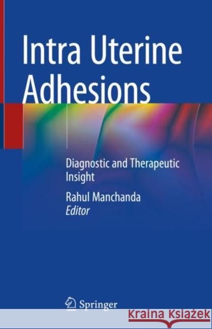 Intra Uterine Adhesions: Diagnostic and Therapeutic Insight Rahul Manchanda 9789813341449 Springer - książka