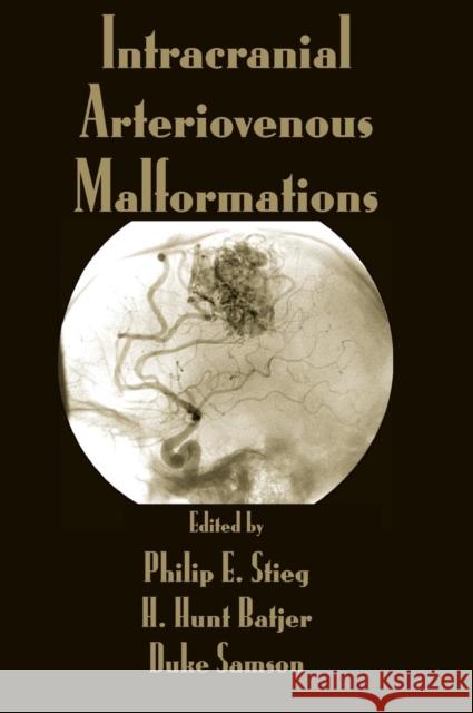 Intracranial Arteriovenous Malformations Philip E. Stieg Duke Samson H. Hunt Batjer 9780824709938 Informa Healthcare - książka