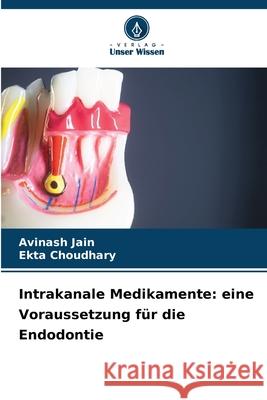 Intrakanale Medikamente: eine Voraussetzung für die Endodontie Jain, Avinash, Choudhary, Ekta 9786206837398 Verlag Unser Wissen - książka