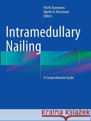 Intramedullary Nailing: A Comprehensive Guide Rommens, Pol M. 9781447171102 Springer - książka