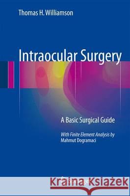 Intraocular Surgery: A Basic Surgical Guide Williamson, Thomas H. 9783319279886 Springer - książka