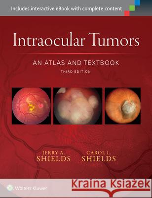 Intraocular Tumors: An Atlas and Textbook: Volume 1 Shields, Jerry A. 9781496321343 Lww - książka