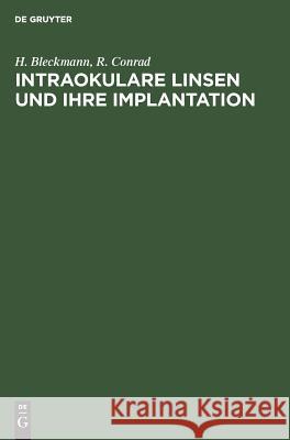 Intraokulare Linsen und ihre Implantation Bleckmann, H. 9783110110821 Walter de Gruyter - książka