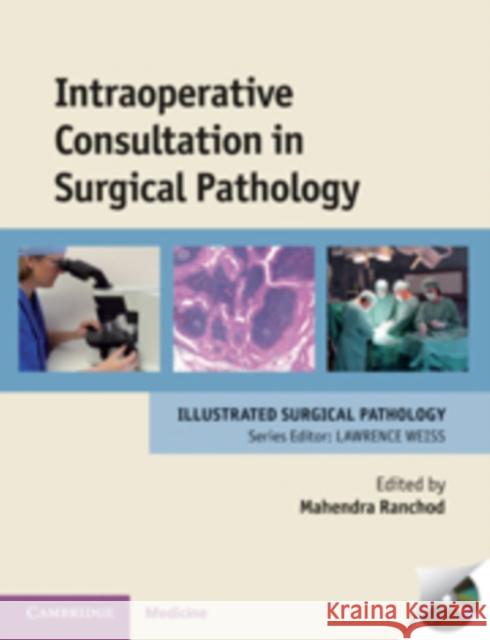 Intraoperative Consultation in Surgical Pathology Mahendra Ranchod 9780521897679  - książka