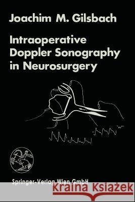 Intraoperative Doppler Sonography in Neurosurgery J. M. Gilsbach 9783211817681 Springer - książka