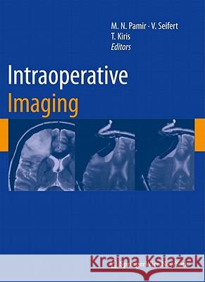 Intraoperative Imaging M. Necmettin Pamir Volker Seifert Talat Kiris 9783211996508 Not Avail - książka