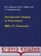 Intraoperative Imaging in Neurosurgery: Mri, Ct, Ultrasound Bernays, R. L. 9783211838358 Springer Vienna - książka