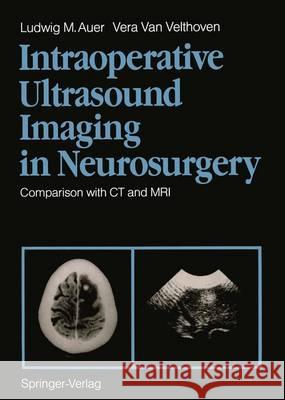 Intraoperative Ultrasound Imaging in Neurosurgery: Comparison with CT and MRI Auer, Ludwig M. 9783642740473 Springer - książka