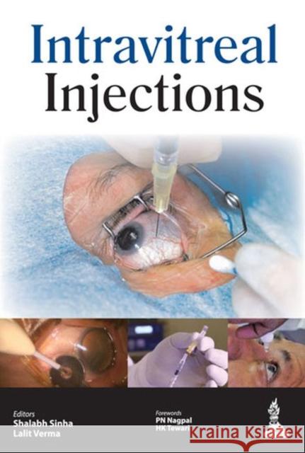 Intravitreal Injections Shilabh Sinha 9789351521020 Jp Medical Ltd - książka