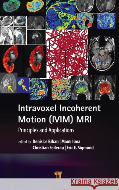 Intravoxel Incoherent Motion (IVIM) MRI: Principles and Applications Denis L Mami Lima Christian Federau 9789814800198 Pan Stanford Publishing - książka