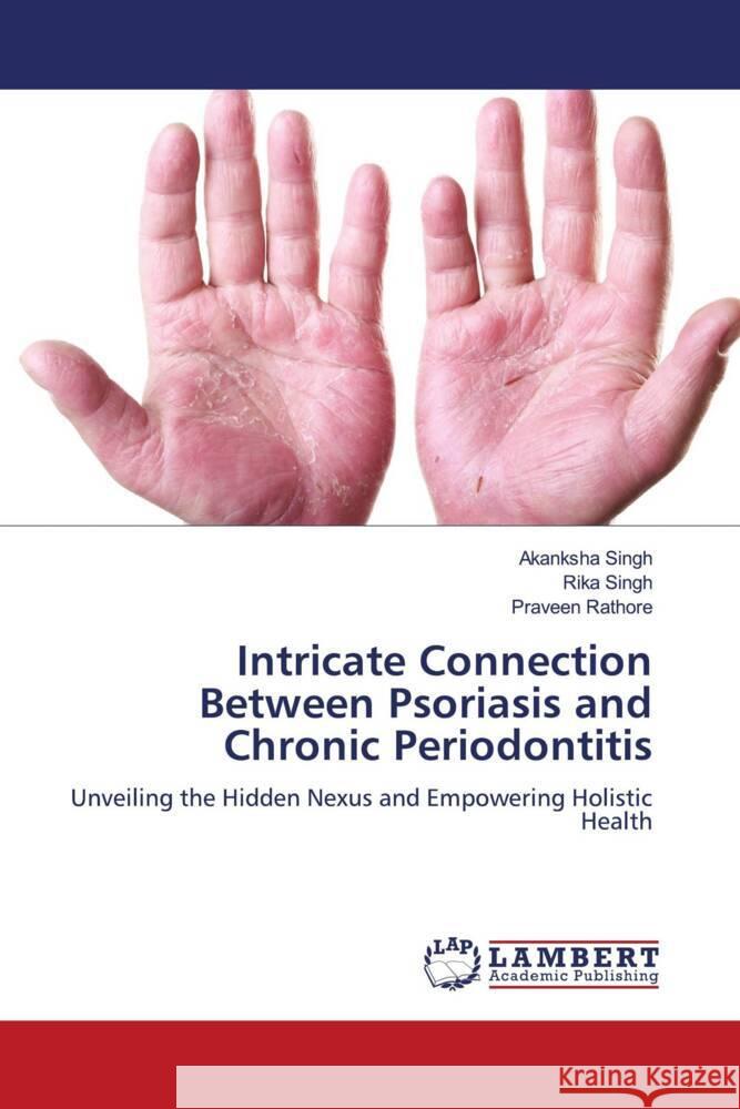 Intricate Connection Between Psoriasis and Chronic Periodontitis Akanksha Singh Rika Singh Praveen Rathore 9786208170493 LAP Lambert Academic Publishing - książka