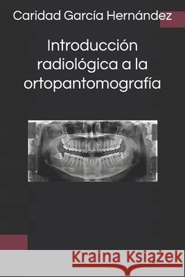 Introducción radiológica a la ortopantomografía Daniel Sanchez Calvo, Pedro Antonio Gallego Fernández, Caridad García Hernández 9798335497664 Independently Published - książka
