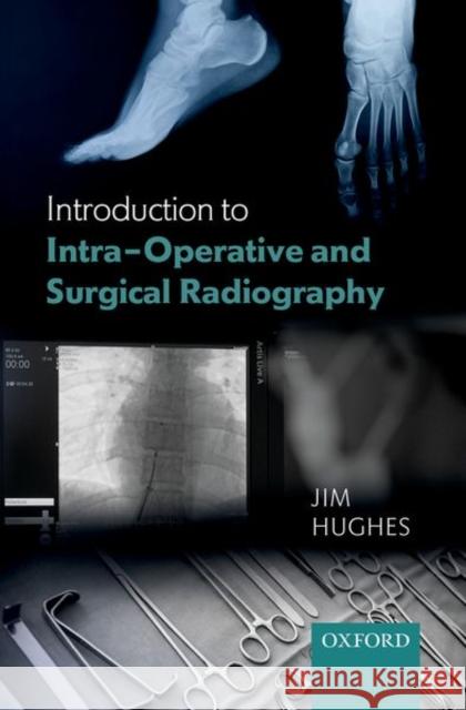 Introduction to Intra-Operative and Surgical Radiography Jim Hughes 9780198813170 Oxford University Press, USA - książka