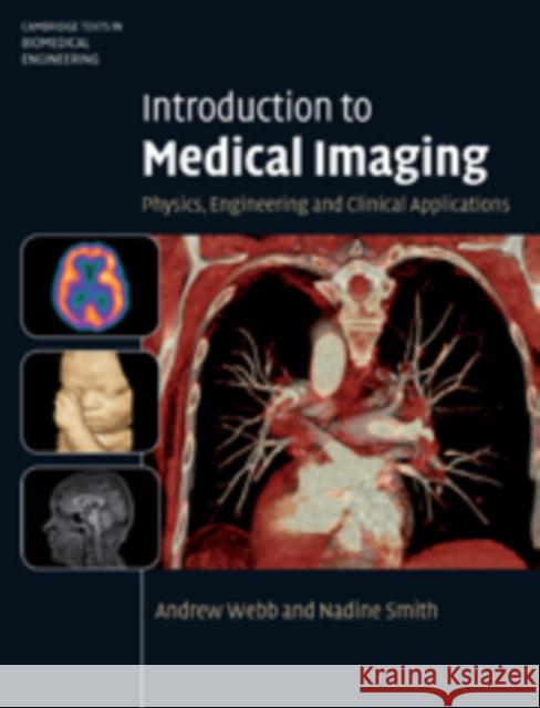 Introduction to Medical Imaging: Physics, Engineering and Clinical Applications Smith, Nadine Barrie 9780521190657 Cambridge University Press - książka