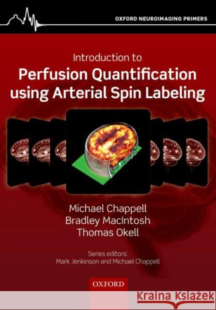 Introduction to Perfusion Quantification Using Arterial Spin Labelling Michael Chappell Bradley Macintosh Thomas Okell 9780198793816 Oxford University Press, USA - książka