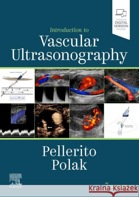 Introduction to Vascular Ultrasonography John Pellerito Joseph F. Polak 9780323428828 Elsevier - książka