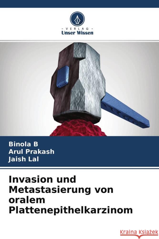 Invasion und Metastasierung von oralem Plattenepithelkarzinom B, Binola, Prakash, Arul, Lal, Jaish 9786204348797 Verlag Unser Wissen - książka