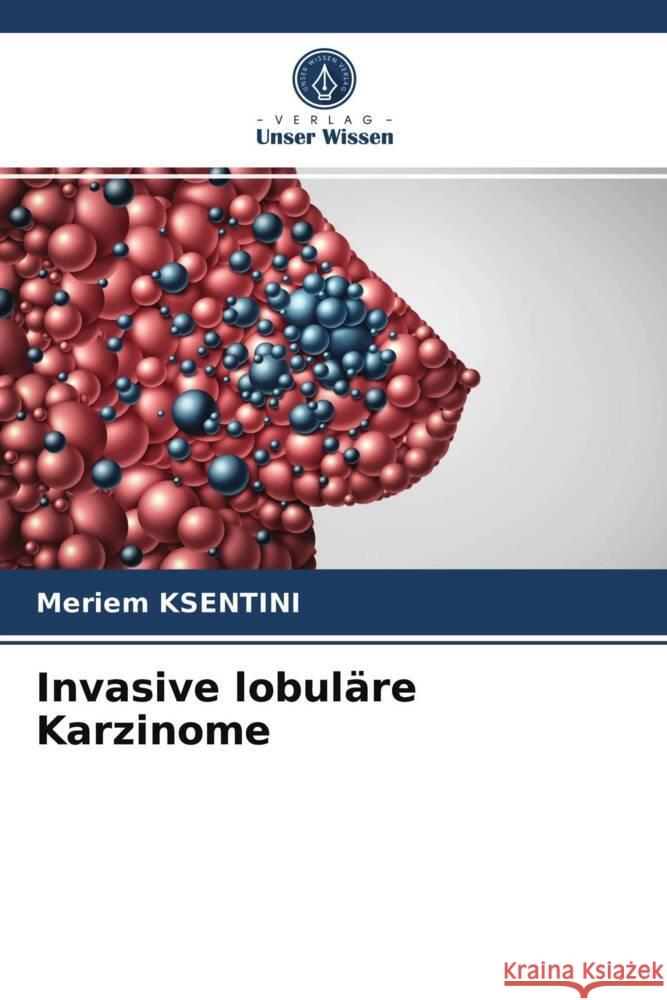 Invasive lobuläre Karzinome KSENTINI, Meriem 9786203702873 Verlag Unser Wissen - książka