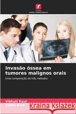 Invas?o ?ssea em tumores malignos orais Vibhuti Kaul Rudra Kaul 9786207689248 Edicoes Nosso Conhecimento - książka