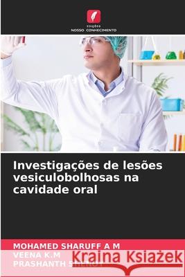 Investiga??es de les?es vesiculobolhosas na cavidade oral Mohamed Sharuff Veena K Prashanth Shenoy 9786207617395 Edicoes Nosso Conhecimento - książka