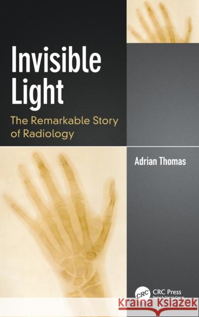 Invisible Light: The Remarkable Story of Radiology Thomas, Adrian 9780367344269 Taylor & Francis Ltd - książka