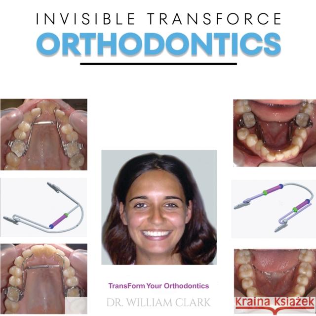 Invisible TransForce Orthodontics William Clark 9781528946131 Austin Macauley Publishers - książka