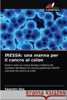 Iressa: una manna per il cancro al colon Saprativ Das 9786202869416 Edizioni Sapienza - książka