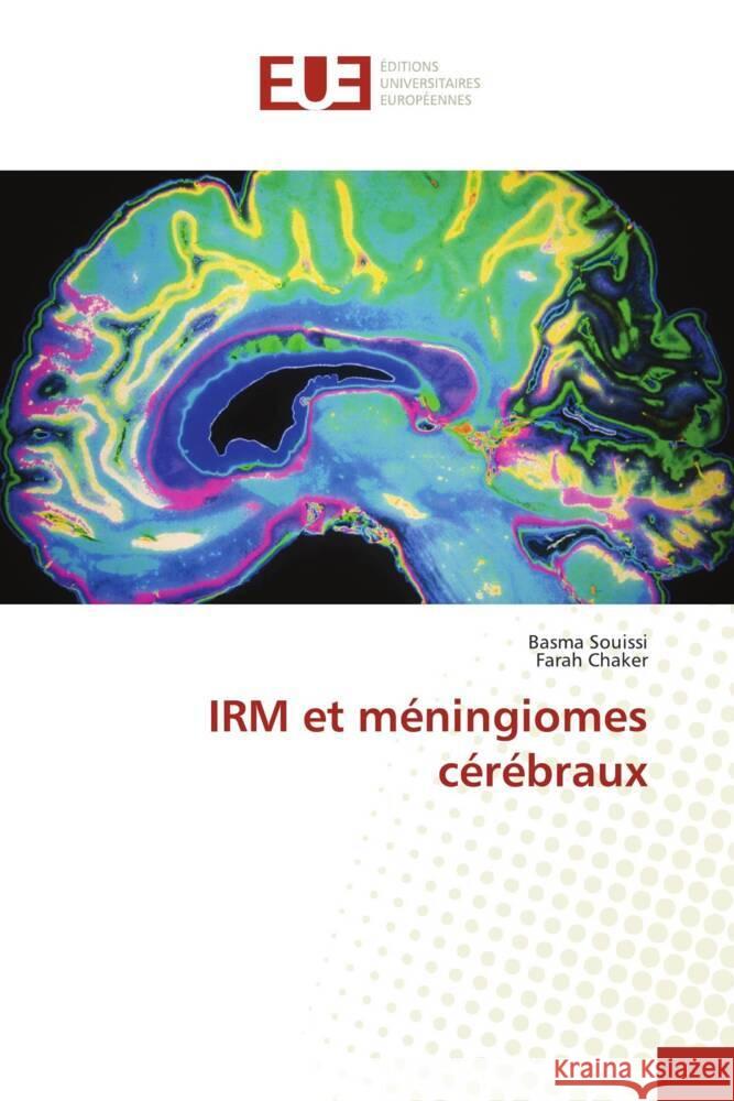 IRM et méningiomes cérébraux Souissi, Basma, Chaker, Farah 9786206723240 Éditions universitaires européennes - książka