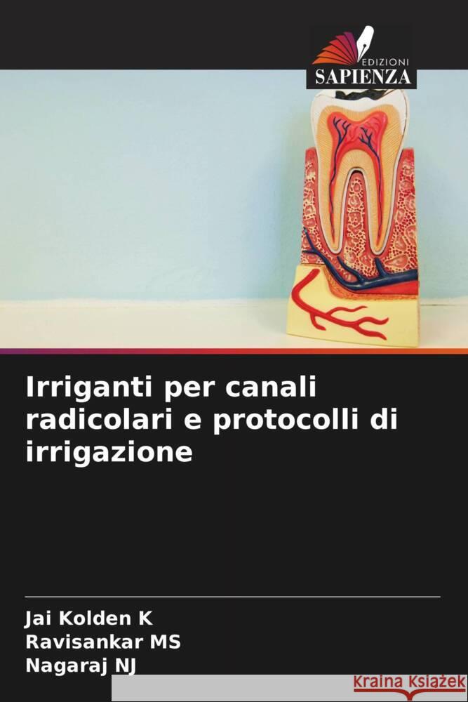 Irriganti per canali radicolari e protocolli di irrigazione K, Jai Kolden, MS, Ravisankar, NJ, Nagaraj 9786204595962 Edizioni Sapienza - książka