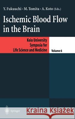 Ischemic Blood Flow in the Brain Y. Fukuuchi M. Tomita A. Koto 9784431702924 Springer Japan - książka