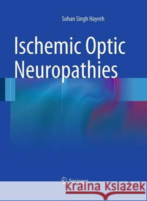 Ischemic Optic Neuropathies Sohan Singh Hayreh 9783642430589 Springer - książka