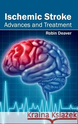 Ischemic Stroke: Advances and Treatment Robin Deaver 9781632412713 Hayle Medical - książka