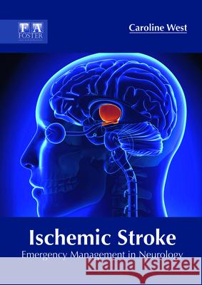 Ischemic Stroke: Emergency Management in Neurology Caroline West 9781632425515 Foster Academics - książka