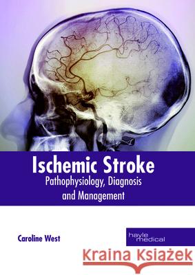 Ischemic Stroke: Pathophysiology, Diagnosis and Management Caroline West 9781632415035 Hayle Medical - książka
