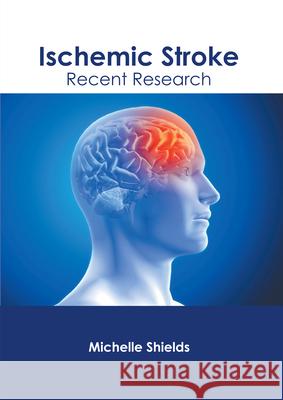 Ischemic Stroke: Recent Research Michelle Shields 9781632429179 Foster Academics - książka