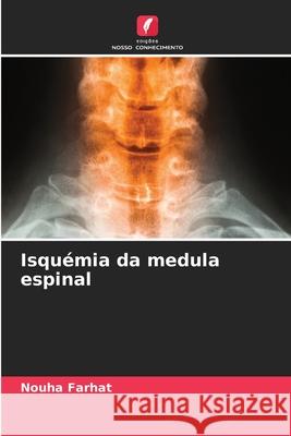 Isqu?mia da medula espinal Nouha Farhat 9786207904303 Edicoes Nosso Conhecimento - książka