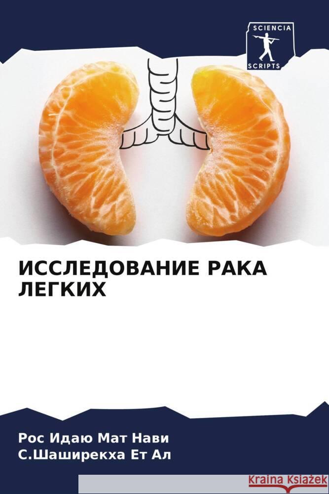 ISSLEDOVANIE RAKA LEGKIH Mat Nawi, Ros Idaü, Et Al, S.Shashirekha 9786204993331 Sciencia Scripts - książka