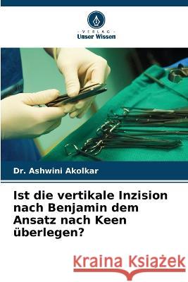 Ist die vertikale Inzision nach Benjamin dem Ansatz nach Keen uberlegen? Dr Ashwini Akolkar   9786206125846 Verlag Unser Wissen - książka