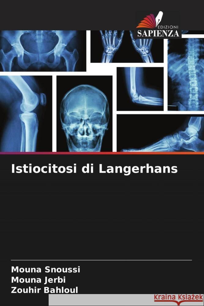 Istiocitosi di Langerhans Mouna Snoussi Mouna Jerbi Zouhir Bahloul 9786206974710 Edizioni Sapienza - książka