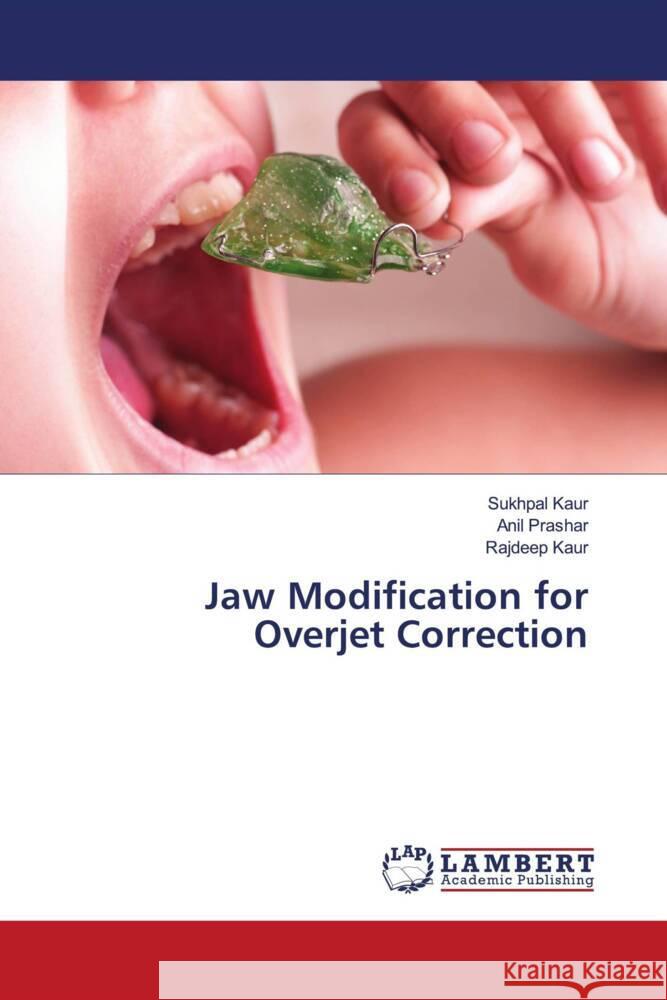 Jaw Modification for Overjet Correction Kaur, Sukhpal, Prashar, Anil, Kaur, Rajdeep 9786208441845 LAP Lambert Academic Publishing - książka