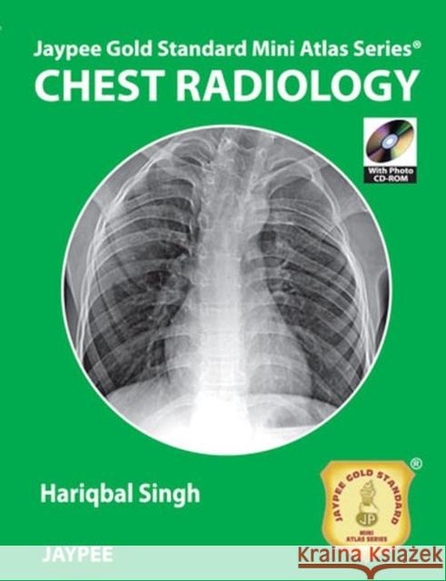 Jaypee Gold Standard Mini Atlas Series: Chest Radiology Hariqbal Singh 9789350904633  - książka