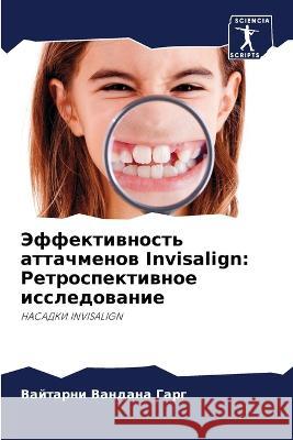 Jeffektiwnost' attachmenow Invisalign: Retrospektiwnoe issledowanie Garg, Vajtarni Vandana 9786206094586 Sciencia Scripts - książka