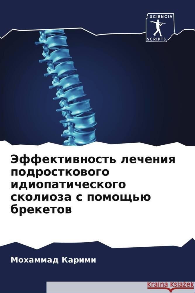 Jeffektiwnost' lecheniq podrostkowogo idiopaticheskogo skolioza s pomosch'ü breketow Karimi, Mohammad 9786204582498 Sciencia Scripts - książka