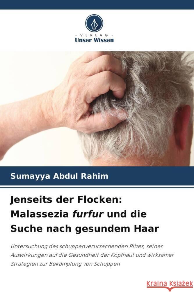 Jenseits der Flocken: Malassezia furfur und die Suche nach gesundem Haar Abdul Rahim, Sumayya 9786208584078 Verlag Unser Wissen - książka