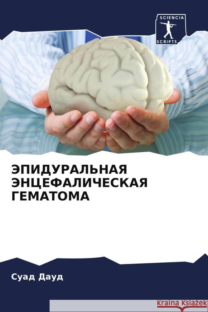 JePIDURAL'NAYa JeNCEFALIChESKAYa GEMATOMA Daud, Suad 9786207037926 Sciencia Scripts - książka