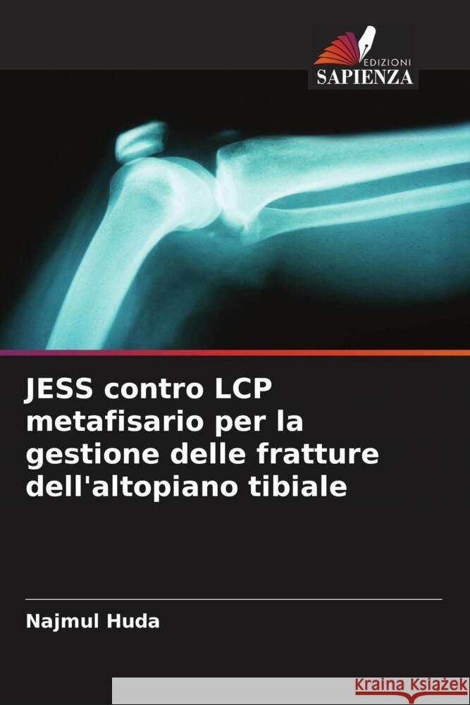 JESS contro LCP metafisario per la gestione delle fratture dell'altopiano tibiale Huda, Najmul 9786205457757 Edizioni Sapienza - książka